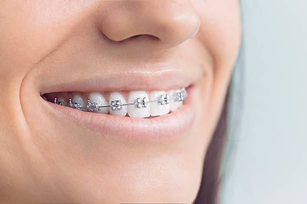 Why Choose Us for Your Dental Needs in Bridgeton, MO